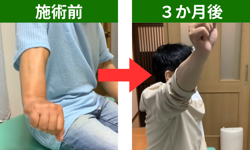 施術後１